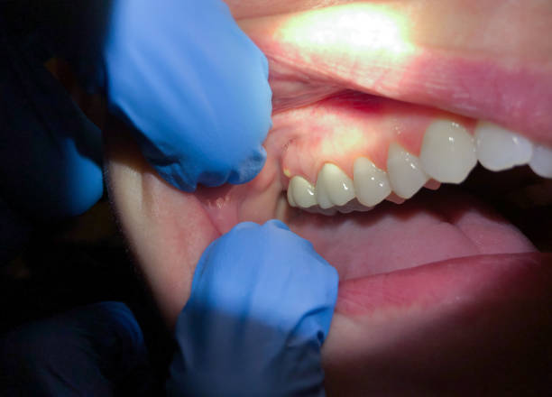 Best Cracked Tooth Emergency Dentist  in Sun Prairie, WI